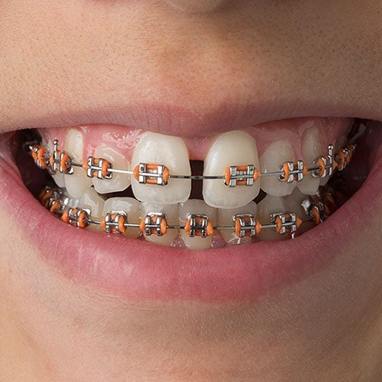 - RockCenter Orthodontics